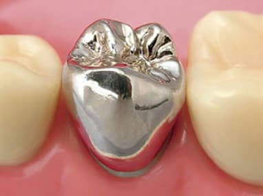 新浦安（浦安市）の歯医者の審美歯科治療