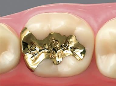 新浦安（浦安市）の歯医者の審美歯科治療